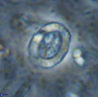 Ataktolithos multicavus 14143