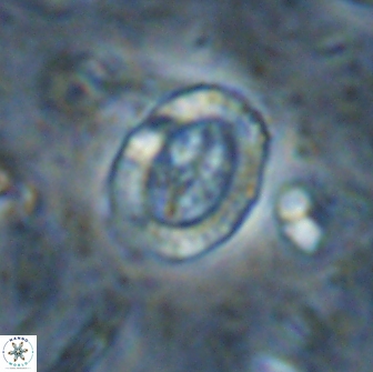 Ataktolithos multicavus 14143