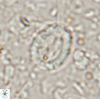 Ataktolithos multicavus 14144