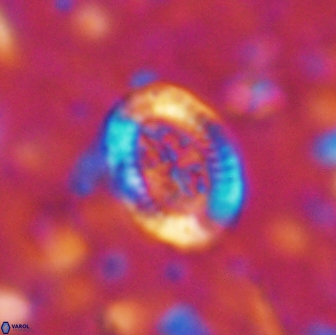 Ataktolithos multicavus 14150