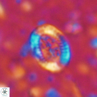 Ataktolithos multicavus 14150
