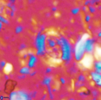 Ataktolithos multicavus 14108