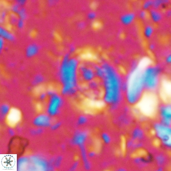 Ataktolithos multicavus 14108
