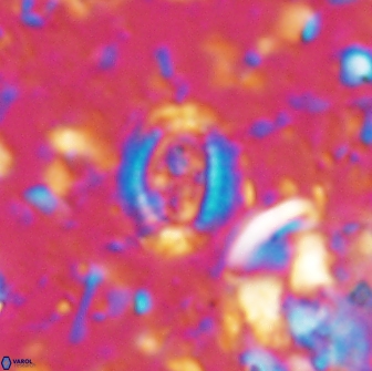 Ataktolithos multicavus 14109