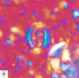 Ataktolithos multicavus 14109