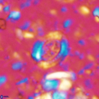 Ataktolithos multicavus 14112