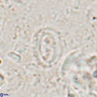 Ataktolithos multicavus 14113