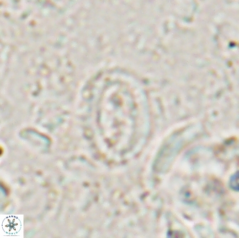Ataktolithos multicavus 14113