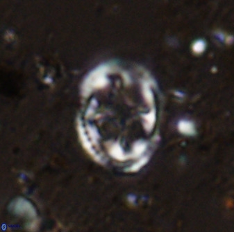 Axopodorhabdus albianus 42365