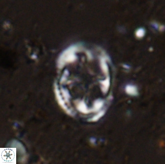 Axopodorhabdus albianus 42365