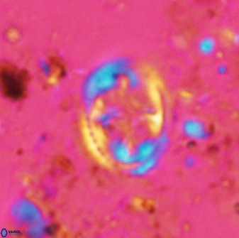 Axopodorhabdus albianus 42366