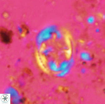 Axopodorhabdus albianus 42366