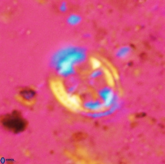 Axopodorhabdus albianus 42368