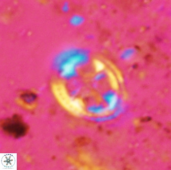 Axopodorhabdus albianus 42368