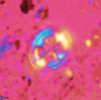 Axopodorhabdus albianus 42370