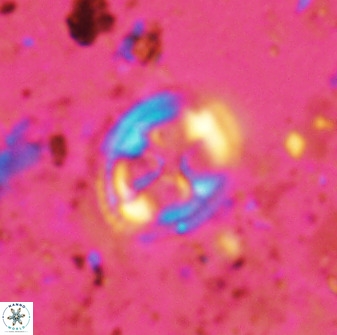 Axopodorhabdus albianus 42370