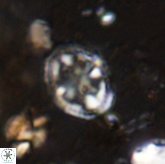 Axopodorhabdus albianus 42371