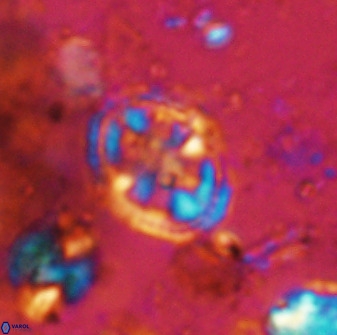 Axopodorhabdus albianus 42372