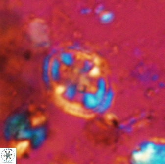 Axopodorhabdus albianus 42372