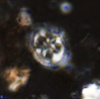 Axopodorhabdus albianus 42373