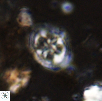 Axopodorhabdus albianus 42373