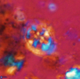 Axopodorhabdus albianus 42374