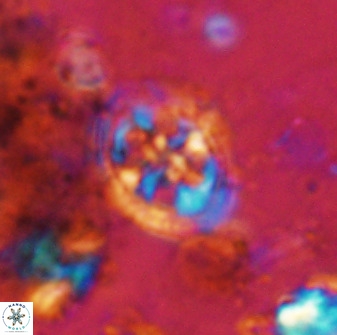 Axopodorhabdus albianus 42374