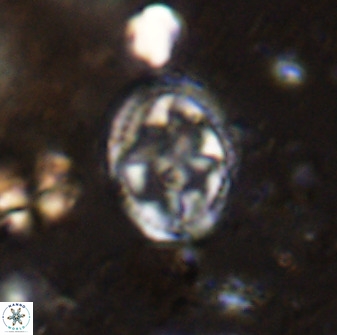Axopodorhabdus albianus 42375