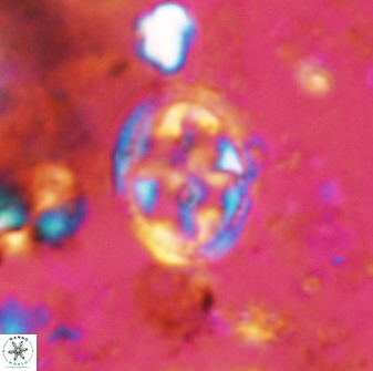 Axopodorhabdus albianus 42376
