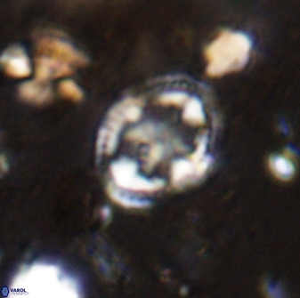 Axopodorhabdus albianus 42377