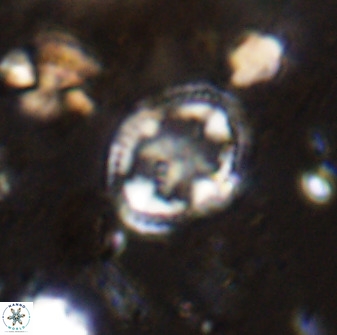 Axopodorhabdus albianus 42377