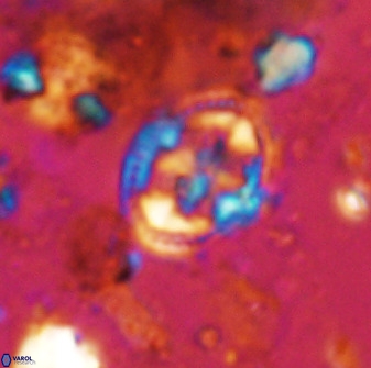 Axopodorhabdus albianus 42378