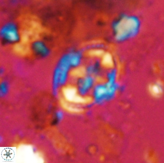 Axopodorhabdus albianus 42378