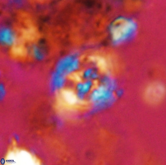 Axopodorhabdus albianus 42379