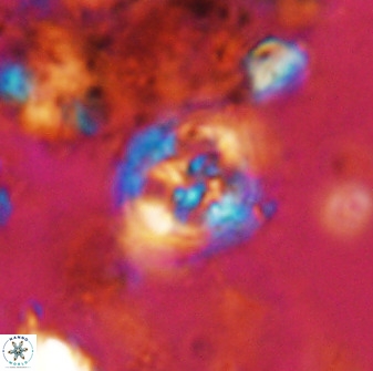 Axopodorhabdus albianus 42379