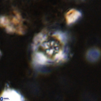 Axopodorhabdus albianus 42380