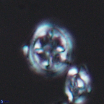 Axopodorhabdus albianus 8125