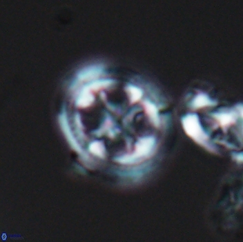 Axopodorhabdus albianus 8123