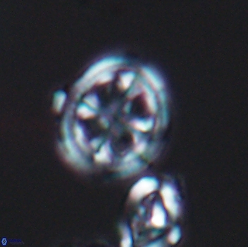 Axopodorhabdus albianus 8131