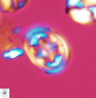 Axopodorhabdus albianus 8245