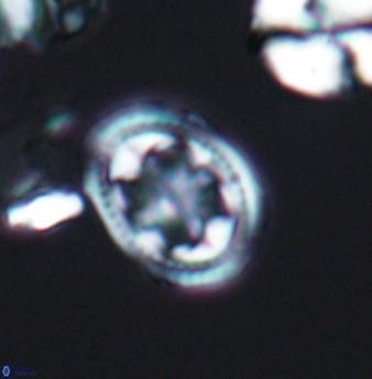 Axopodorhabdus albianus 8246