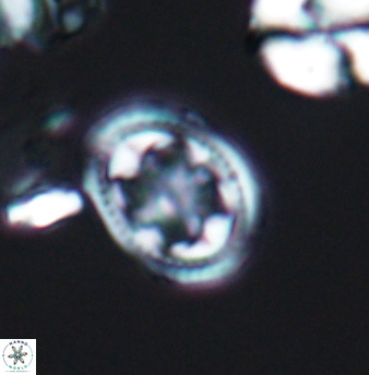 Axopodorhabdus albianus 8246