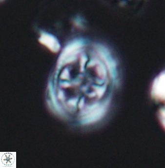 Axopodorhabdus albianus 8247
