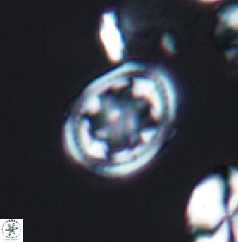 Axopodorhabdus albianus 8250