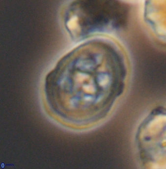 Axopodorhabdus albianus 8251