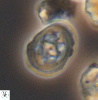 Axopodorhabdus albianus 8251