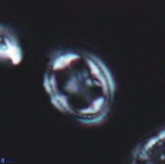 Axopodorhabdus albianus 8324