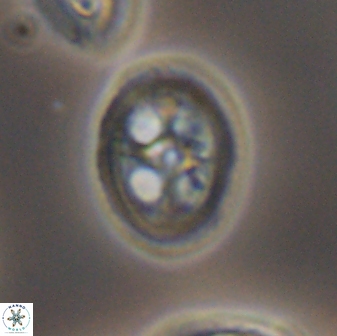 Axopodorhabdus albianus 8330