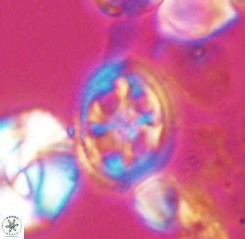 Axopodorhabdus albianus 8414