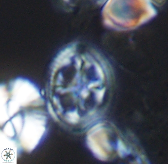 Axopodorhabdus albianus 8415